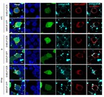 Synthetic in vitro transcribed lncRNAs (SINEUPs) with chemical modifications enhance target mRNA translation